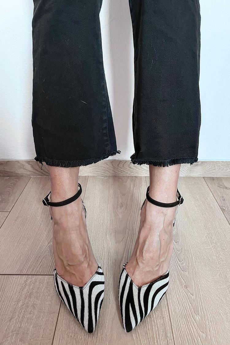 ZEBRA PRINT PUMPS WITH ANKLE STRAP - SUNDRA
